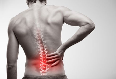 Low Back Pain Saat Bekerja: Penyebab dan Solusinya